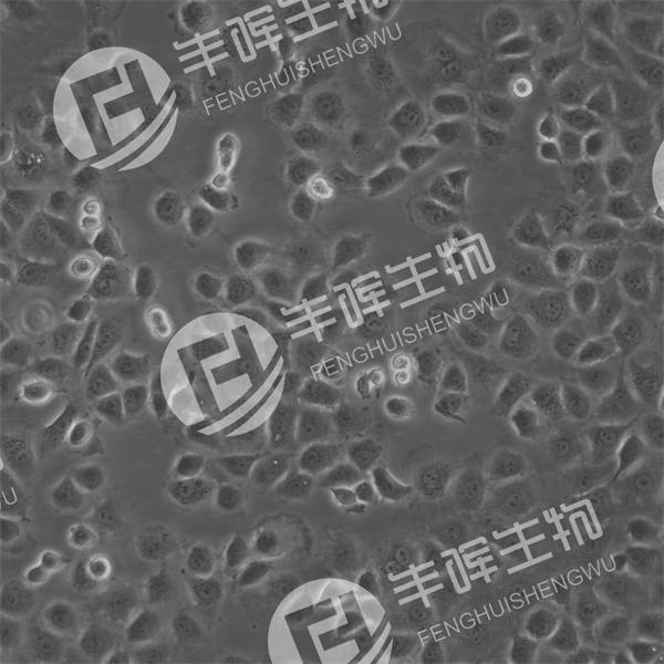 MFC细胞（小鼠前胃癌细胞）